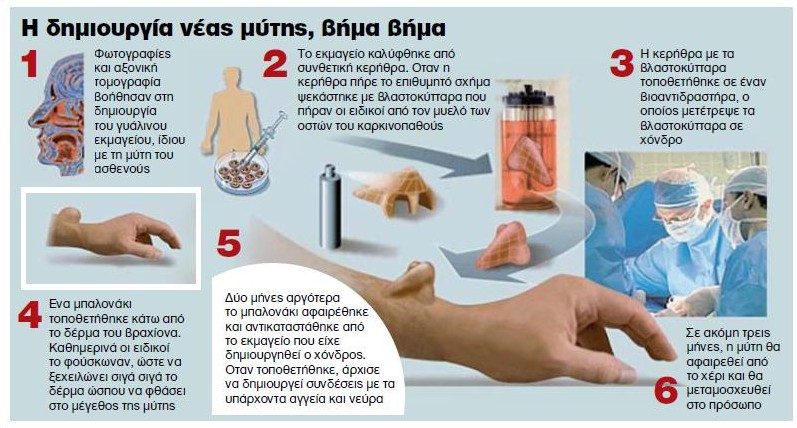 Μια νέα μύτη γεννιέται στο χέρι του