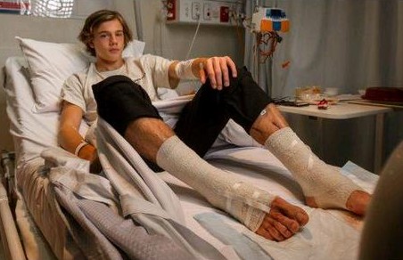 Σοβαρός τραυματισμός εφήβου από «ψείρες της θάλασσας»