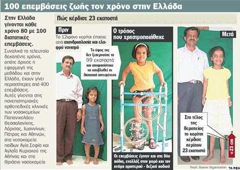 Προσθέτουν έως και 30 εκατοστά ύψος