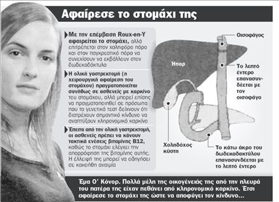 «Έμαθα να ζω δίχως στομάχι»