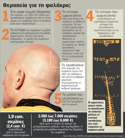 Σώζουν τα μαλλιά  με την κλωνοποίηση