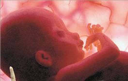 Άνδρας ή γυναίκα; Η απάντηση  δεν είναι και τόσο εύκολη…