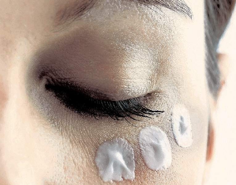 5 πλαστικές χωρίς νυστέρι