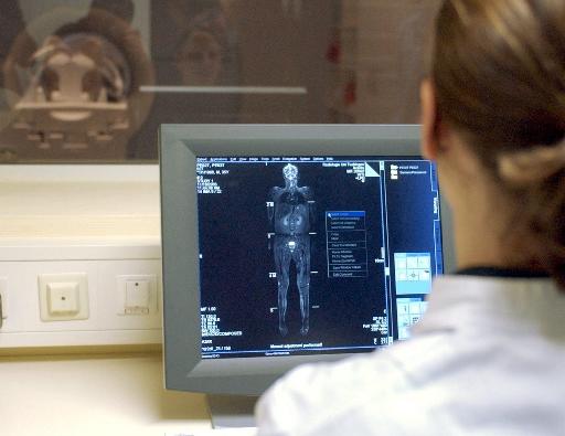 Απειλή για 20άρηδες οι πέτρες στα νεφρά!