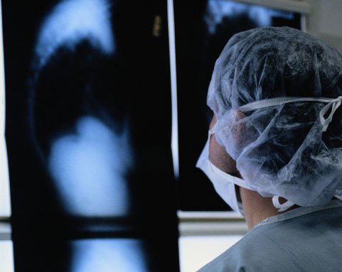 Λάθος μία στις τρεις διαγνώσεις με απλή ακτινογραφία