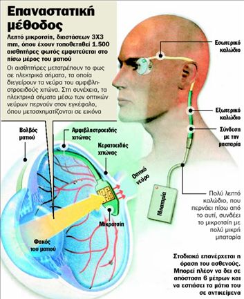 Βλέπει µε βιονικό µάτι!