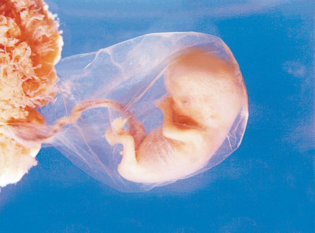 Αιματολογική εξέταση δείχνει το φύλο 
του εμβρύου μετά την έβδομη εβδομάδα