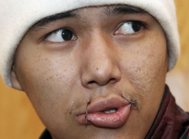 Κιργιστάν: 640 κρατούμενοι έραψαν τα χείλη τους