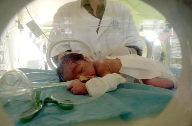 Έκαναν εγχείρηση ανοιχτής καρδιάς σε νεογέννητο 17,5… ωρών