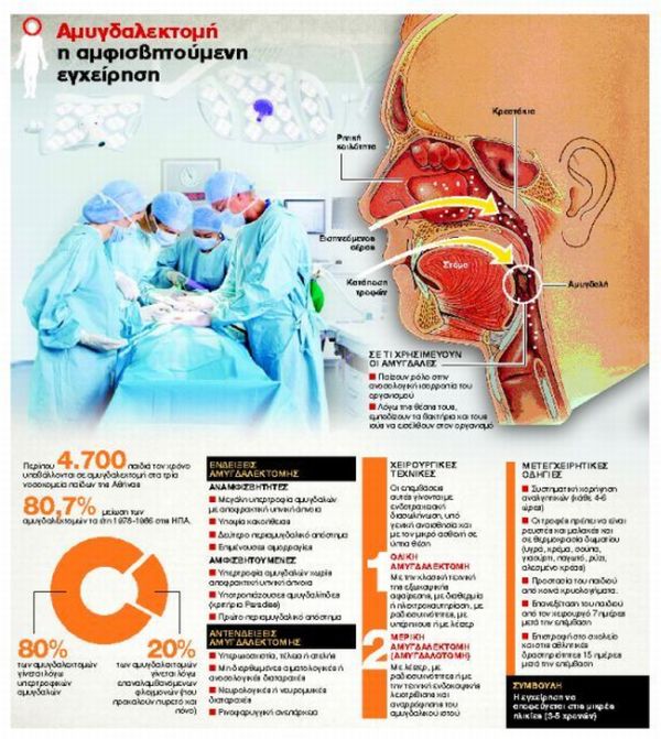 Μύθοι και αλήθειες για τις αμυγδαλές