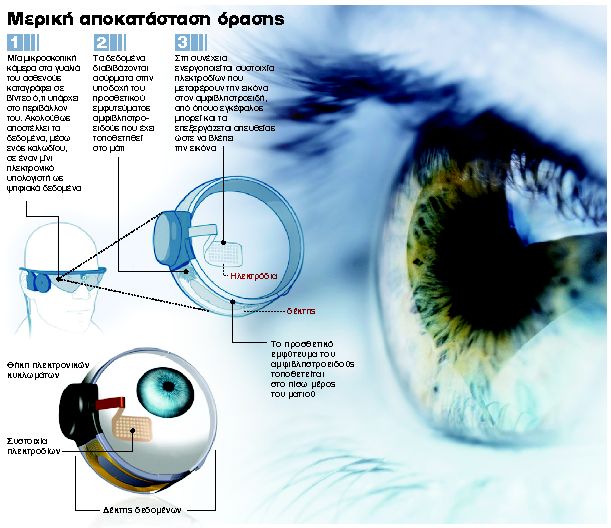 Επίσημο OK για το βιονικό μάτι