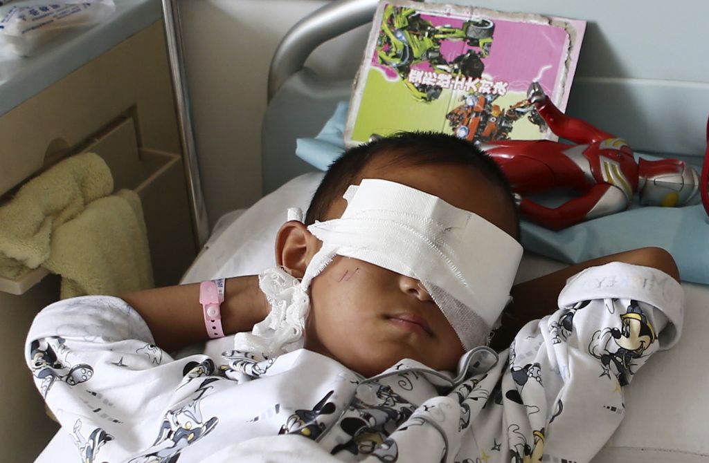 Φρίκη στην Κίνα: Απήγαγαν εξάχρονο αγόρι και του έβγαλαν τα μάτια για να τα πουλήσουν!