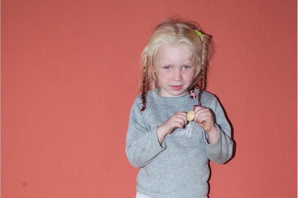 Παγκόσμια συγκίνηση για τον «ξανθό άγγελο» – Στις έρευνες για τους γονείς και η Ιντερπόλ