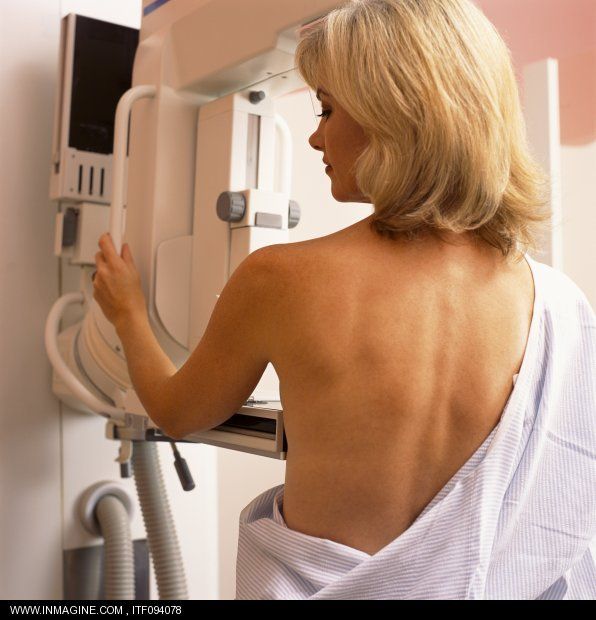 Η χοληστερίνη «τροφοδοτεί τον καρκίνο του μαστού», δείχνει νέα μελέτη