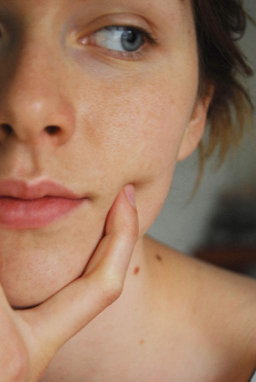 Νέα φάρμακα θεραπεύουν το μεταστατικό μελάνωμα