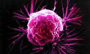 Νέα εξέταση ανιχνεύει τον καρκίνο σε λίγες ώρες λένε βρετανοί επιστήμονες