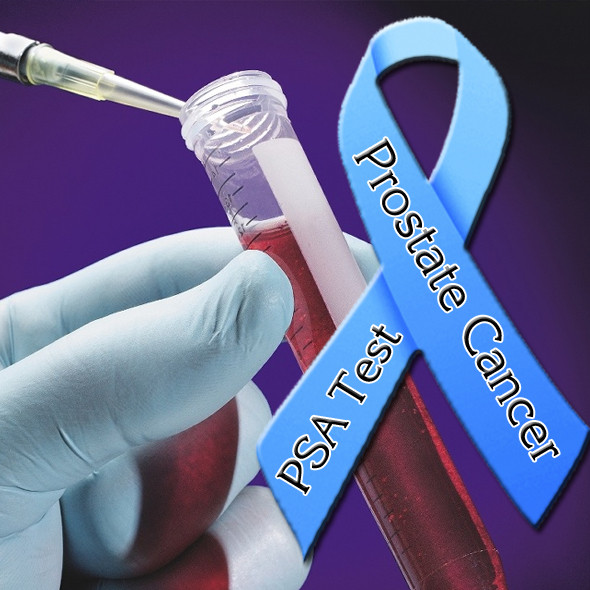 Τεστ DNA «θα αποκαλύπτει τον επιθετικό καρκίνο του προστάτη»