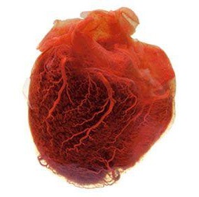 Οι καλοήθεις και κακοήθεις όγκοι της καρδιάς