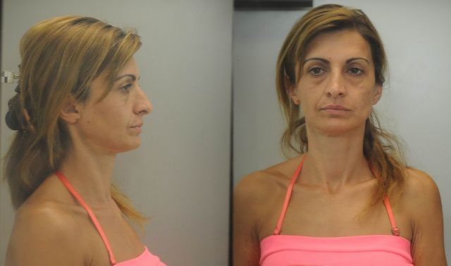 Συνελήφθη 44χρονη Γεωργιανή οικιακή βοηθός για κλοπές
