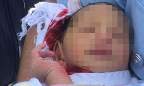 Αυστραλία: Γυναίκα πέταξε το νεογέννητο παιδί της στον υπόνομο