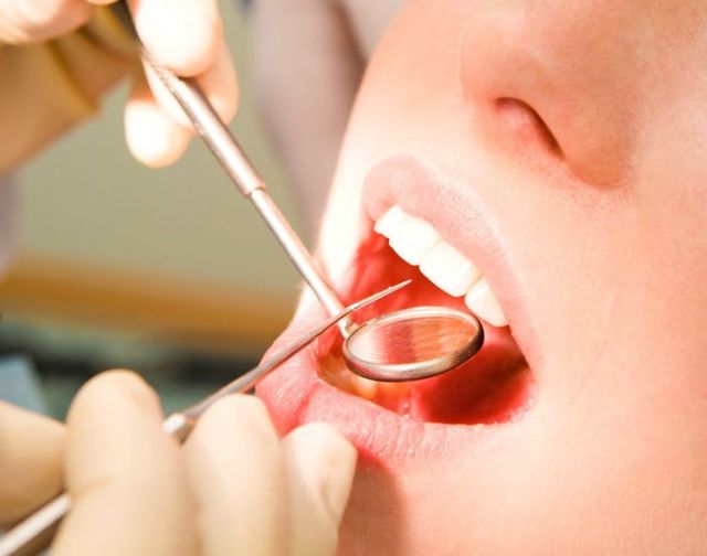 Δικογραφία σε βάρος οδοντιάτρου για μη έκδοση αποδείξεων παροχής υπηρεσιών