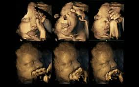 Τους μορφασμούς του εμβρύου όταν η μητέρα ανάβει τσιγάρο δείχνουν 4D υπερηχογραφήματα | tanea.gr