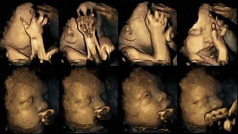 Δείτε πως αντιδρούν τα έμβρυα στο τσιγάρο της μαμάς