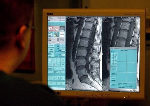 Έχετε δισκοπάθεια; Μπορεί να φταίει ο εσωτερικός σας… χιμπατζής