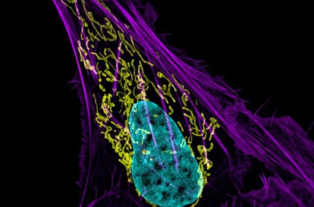 Φάρμακα εμποδίζουν την εξάπλωση του καρκίνου του μαστού στα οστά