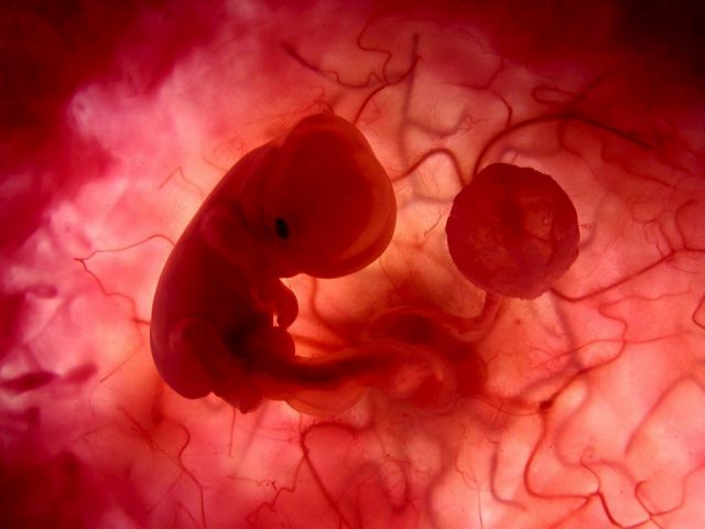 Πρώτη απόπειρα μεταμόσχευσης βλαστοκυττάρων σε αναπτυσσόμενα έμβρυα