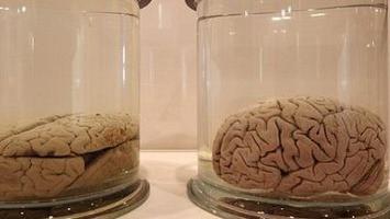 ΗΠΑ:Εκλεψε διατηρημένους ανθρώπινους εγκεφάλους από μουσείο