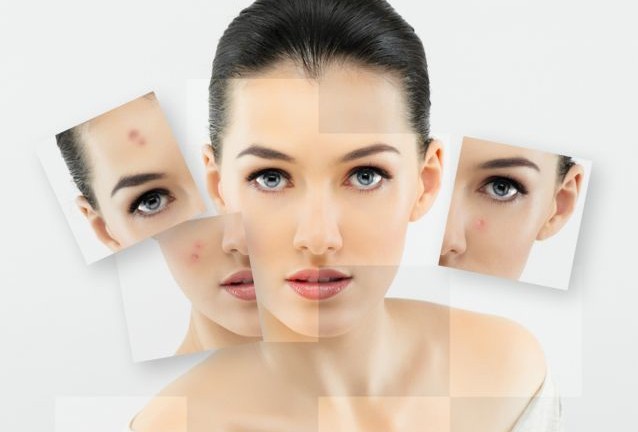 Εγκρίθηκε σπρέι αφρού για τοπική θεραπεία της ψωρίασης