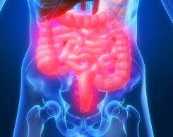 Μικρόβια του στόματος ίσως επιδεινώνουν τον καρκίνο του εντέρου