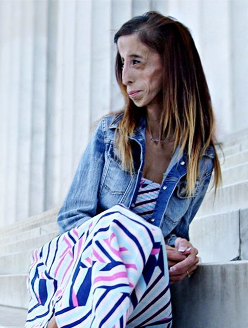 Η «πιο άσχημη γυναίκα στον κόσμο» μιλά για τη ζωή της