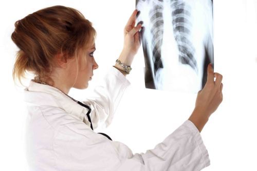 Σωτήριο το τσεκ απ των πνευμόνων για τους καπνιστές