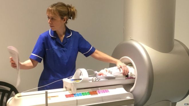 Δημιούργησαν μίνι μαγνητικό τομογράφο για νεογέννητα μωρά