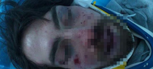 Αγριος ξυλοδαρμός φοιτητή πιθανόν από ομάδα χρυσαυγιτών