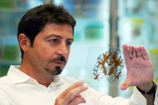 Σκλήρυνση κατά πλάκας: Φάρμακο – ανάσα για τους ασθενείς