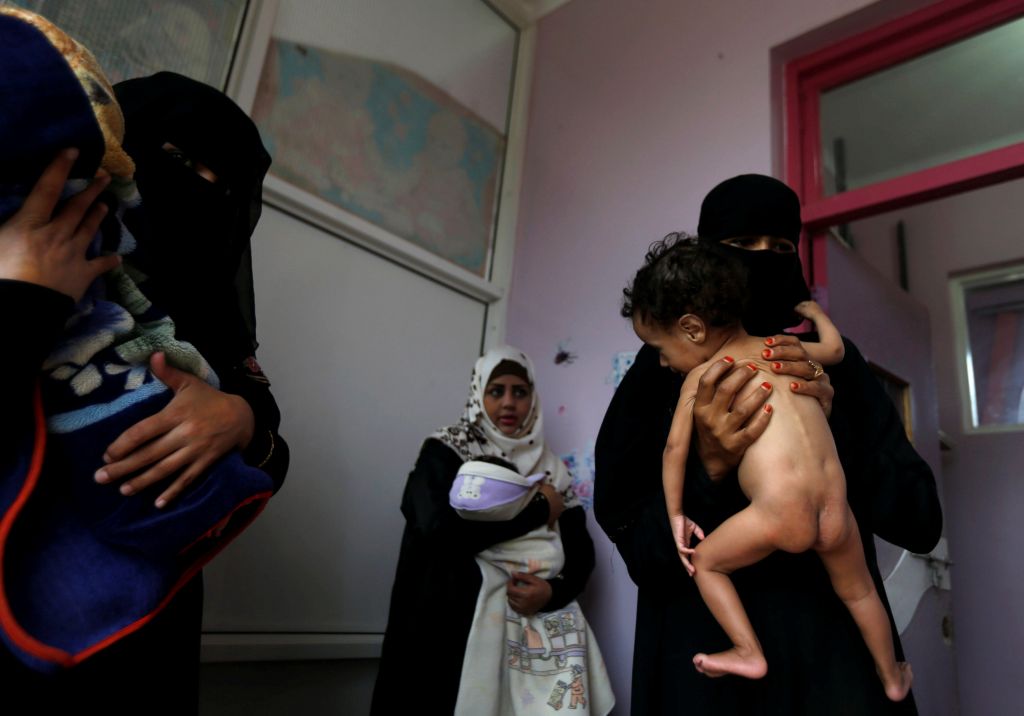 Υεμένη: Σχεδόν 2 εκατ. παιδιά υποφέρουν από οξύ υποσιτισμό
