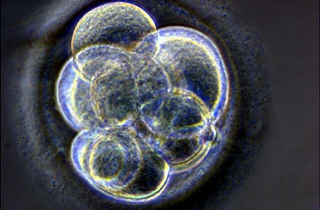 Η καθυστέρηση της εμβρυομεταφοράς αυξάνει την επιτυχία της IVF