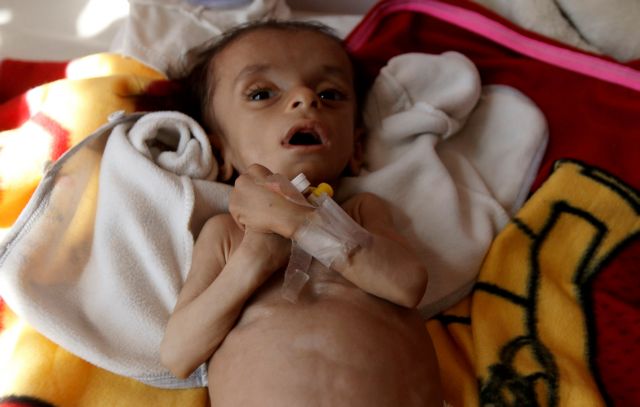 UNICEF: Κάθε δέκα λεπτά ένα παιδί πεθαίνει στην Υεμένη
