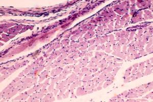 Επιστήμονες δημιούργησαν ανθρώπινο μυ από δερματικά κύτταρα