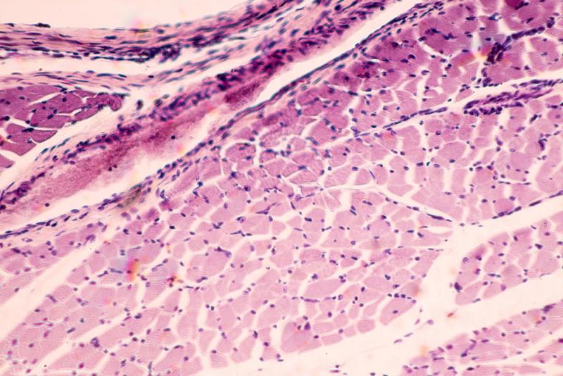 Επιστήμονες δημιούργησαν ανθρώπινο μυ από δερματικά κύτταρα