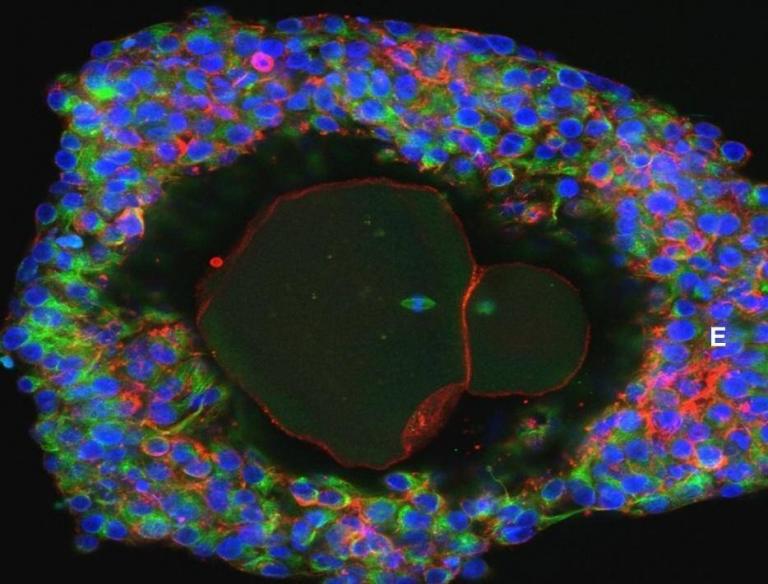 Επιστήμονες δημιούργησαν τα πρώτα ανθρώπινα ωάρια σε εργαστήριο | tanea.gr
