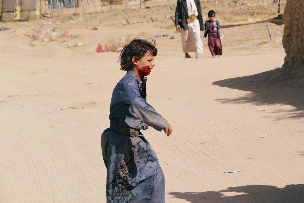 Κι άλλα παιδιά θύματα αεροπορικών επιδρομών στην Υεμένη