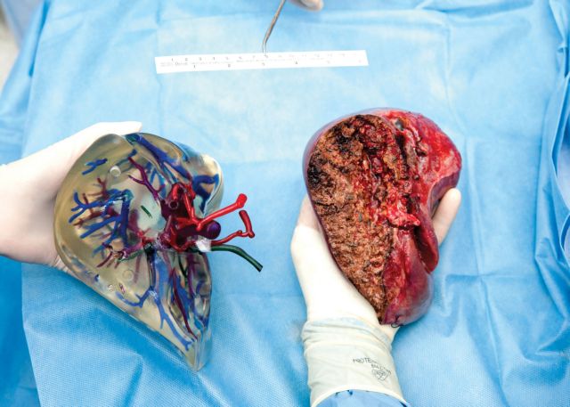 Θεσσαλονίκη: Προσομοίωση εγχειρήσεων σε 3D μοντέλα ανθρώπινων οργάνων