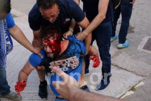 Απίστευτο ξύλο σε αγώνα Γ’ Εθνικής – Εικόνες ντροπής στο ποδόσφαιρο