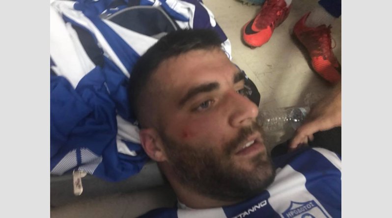 Καταγγελία: Αγριος ξυλοδαρμός σε προπονητή και παίκτες