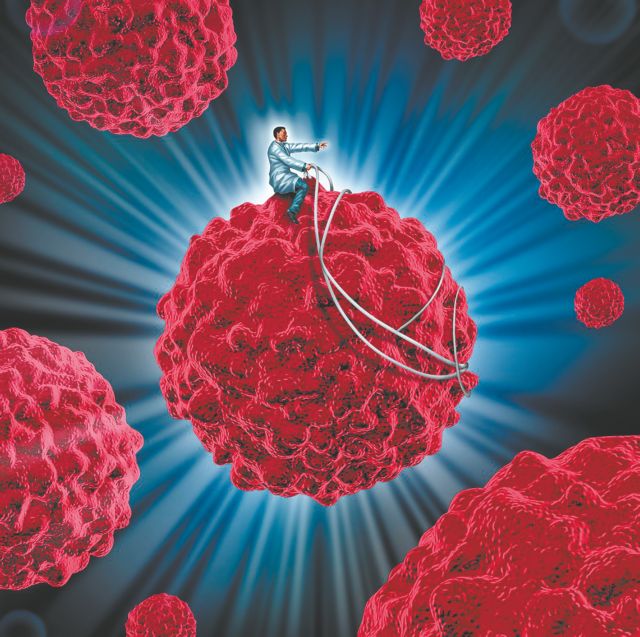 Επανάσταση έφερε η ανοσοθεραπεία στη μάχη με τον καρκίνο του πνεύμονα