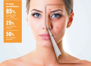 Η ακμή χρόνια δεν κοιτά!